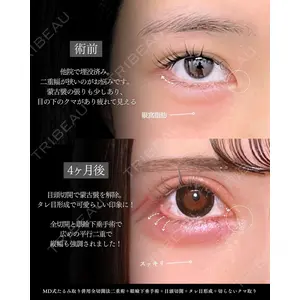 東京シンデレラ美容外科 新宿院 吉原 伯医師の症例