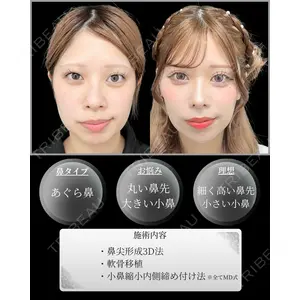 東京シンデレラ美容外科 新宿院 吉原 伯医師の症例