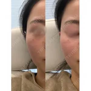 Next Tokyo Clinic 松本 俊太郎医師の症例