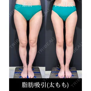 HAAB×DREAM BEAUTY CLINIC 東京本院 吉岡 修一医師の症例