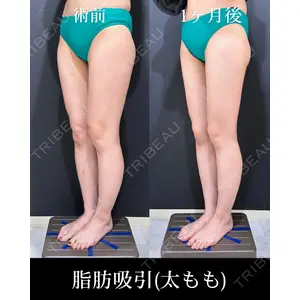 HAAB×DREAM BEAUTY CLINIC 東京本院 吉岡 修一医師の症例