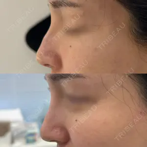 Next Tokyo Clinic 松本 俊太郎医師の症例
