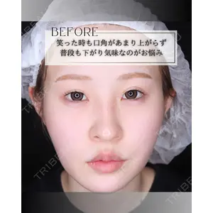 小倉美容外科/美容皮膚科 ビラビューティークリニック 大村 亞蘭医師の症例