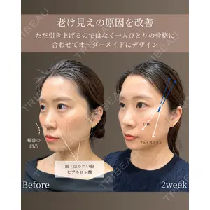 gift clinic 能登谷 翔医師の症例