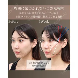 gift clinicの症例