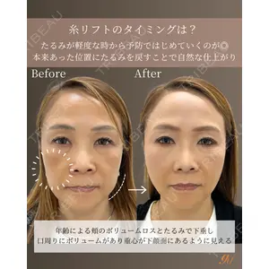 gift clinic 能登谷 翔医師の症例