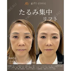 gift clinic 能登谷 翔医師の症例