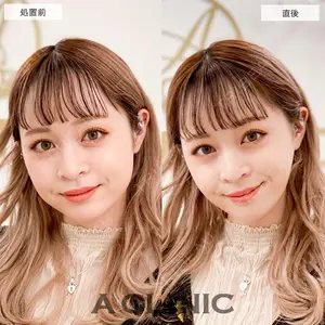 A CLINIC（エークリニック） 仙台院 伊藤 瑠桂医師の症例