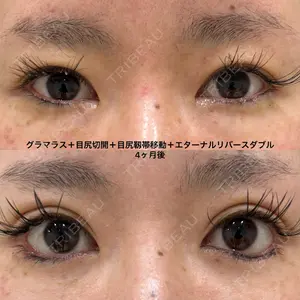 エターナル美容クリニック 久門田 詳医師の症例