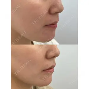 Next Tokyo Clinic 松本 俊太郎医師の症例