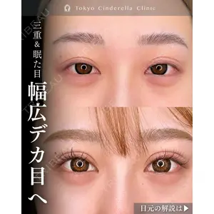 東京シンデレラ美容外科 新宿院 吉原 伯医師の症例