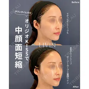 LIVIN CLINIC 新行内 芳明医師の症例
