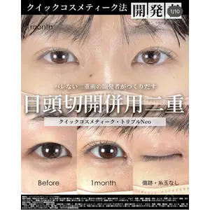湘南美容クリニック 大阪梅田院 横谷 仁彦医師の症例