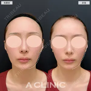 A CLINIC（エークリニック） 銀座院 長谷川 光医師の症例