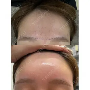 Next Tokyo Clinic 松本 俊太郎医師の症例