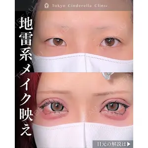 東京シンデレラ美容外科 新宿院 吉原 伯医師の症例