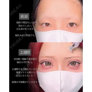 東京シンデレラ美容外科 新宿院 吉原 伯医師の症例