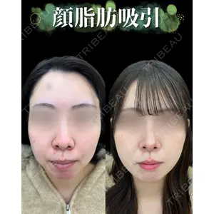 ルラ美容クリニック 町田院 小松 正樹医師の症例