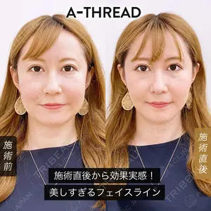 A CLINIC（エークリニック） 新宿院 片桐 大佑医師の症例