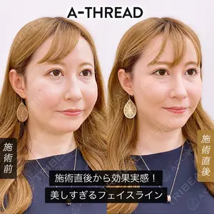 A CLINIC（エークリニック） 新宿院 片桐 大佑医師の症例