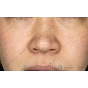 Original Beauty Clinic GINZA 佐藤玲史医師の症例