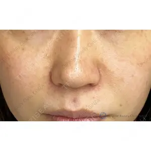 Original Beauty Clinic GINZA 佐藤玲史医師の症例