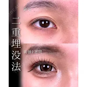 東京シンデレラ美容外科 池袋院 石井 達也医師の症例