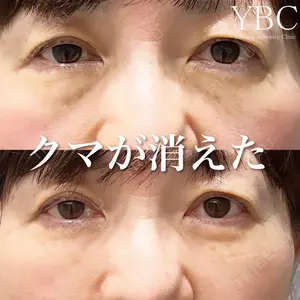 YBC横浜美容外科 大宮院の症例