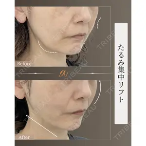 gift clinic 能登谷 翔医師の症例