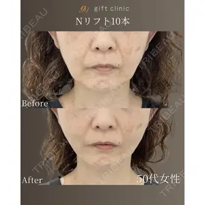 gift clinic 能登谷 翔医師の症例