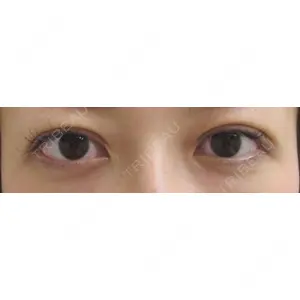 東京エビスクリニック 新藤　英理子医師の症例