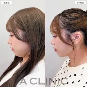 A CLINIC（エークリニック） 福岡院 高平 青洋医師の症例