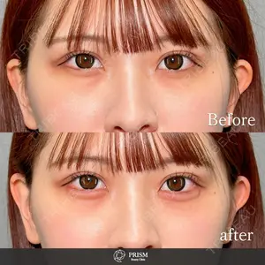PRISM Beauty Clinic 新宿院 畑山 知輝医師の症例