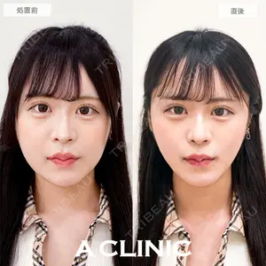 A CLINIC（エークリニック） 銀座院 新妻　克宜医師の症例