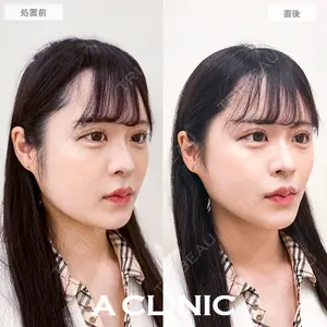 A CLINIC（エークリニック） 銀座院 新妻　克宜医師の症例