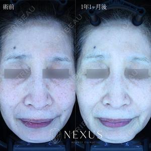 NEXUS CLINICの症例