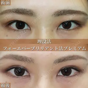 大塚美容形成外科 札幌院の症例