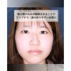 小倉美容外科/美容皮膚科 ビラビューティークリニック 大村 亞蘭医師の症例