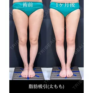 HAAB×DREAM BEAUTY CLINIC 東京本院 吉岡 修一医師の症例