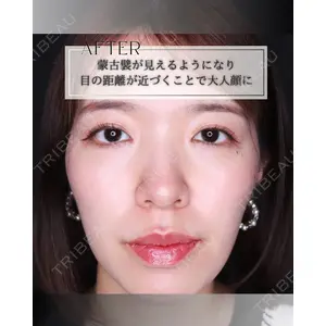 小倉美容外科/美容皮膚科 ビラビューティークリニック 大村 亞蘭医師の症例