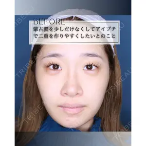 小倉美容外科/美容皮膚科 ビラビューティークリニック 大村 亞蘭医師の症例