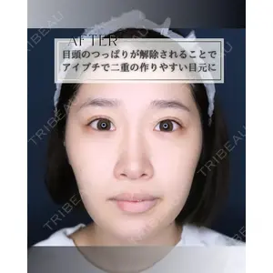小倉美容外科/美容皮膚科 ビラビューティークリニック 大村 亞蘭医師の症例
