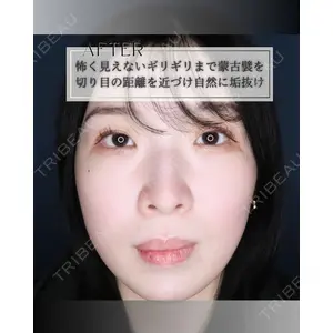 小倉美容外科/美容皮膚科 ビラビューティークリニック 大村 亞蘭医師の症例