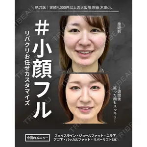 RIVER CLINIC（リバークリニック）大阪院 木家 佑理子医師の症例