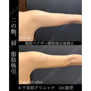 ルラ美容クリニック 札幌院 能登 貴弘医師の症例