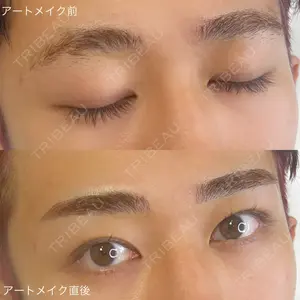 メディカルアートメイク大阪 ISHIDA AKARI医師の症例