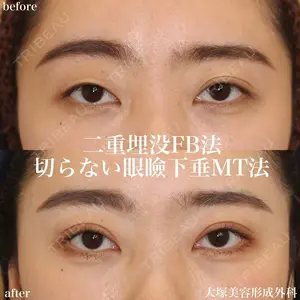 大塚美容形成外科 札幌院の症例