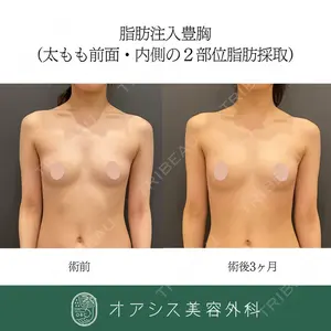 オアシス美容外科 遠藤 剛史医師の症例