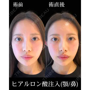 HAAB×DREAM BEAUTY CLINIC 東京本院 佐野 圭医師の症例