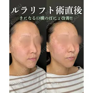 ルラ美容クリニック 岐阜院 馬場 愛理医師の症例